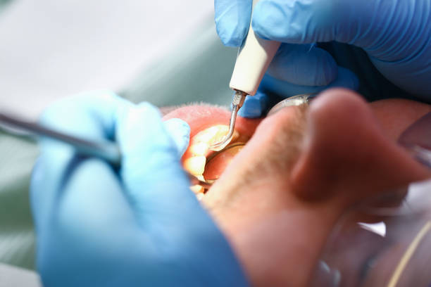 Best Urgent Dental Care for Toothache in North Branch, MI