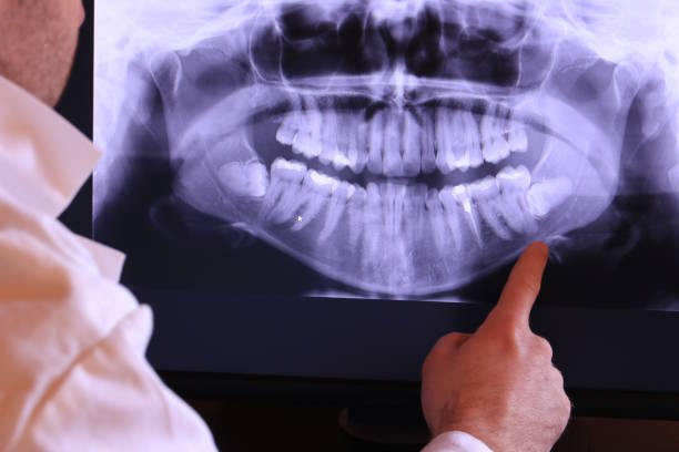 Best Weekend Emergency Dentist in North Branch, MI
